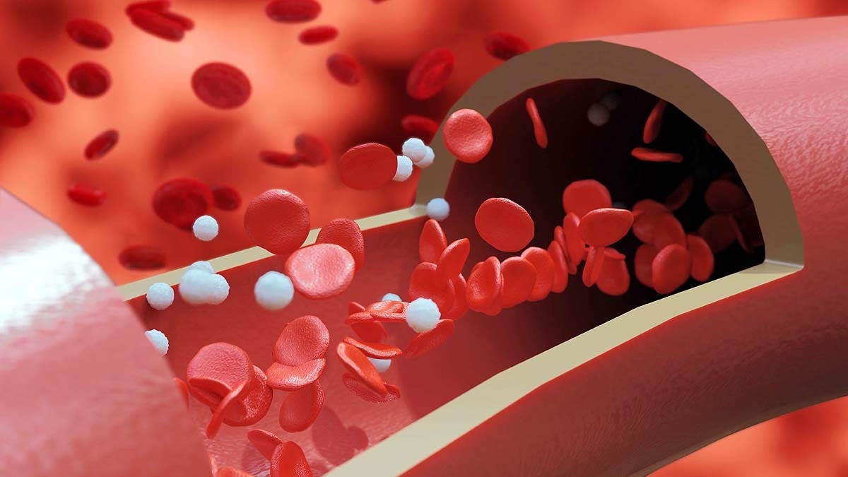 B Blood Group Type 2 Diabetes