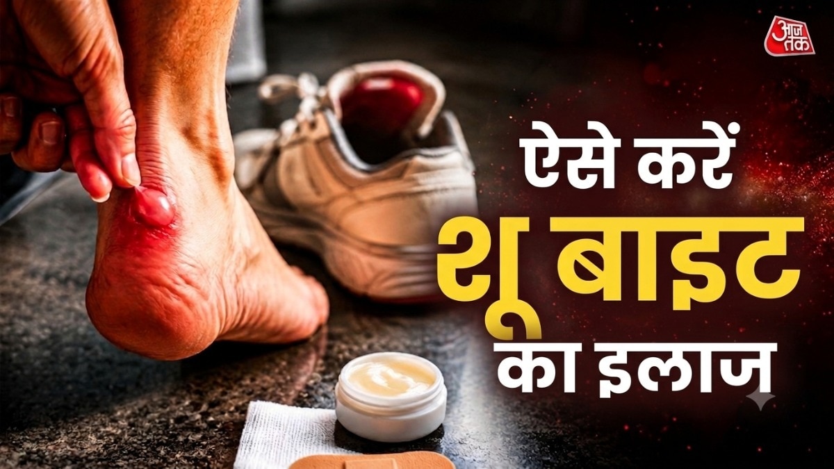 ऐसे करें शूबाइट का इलाज (Photo: ITG) 