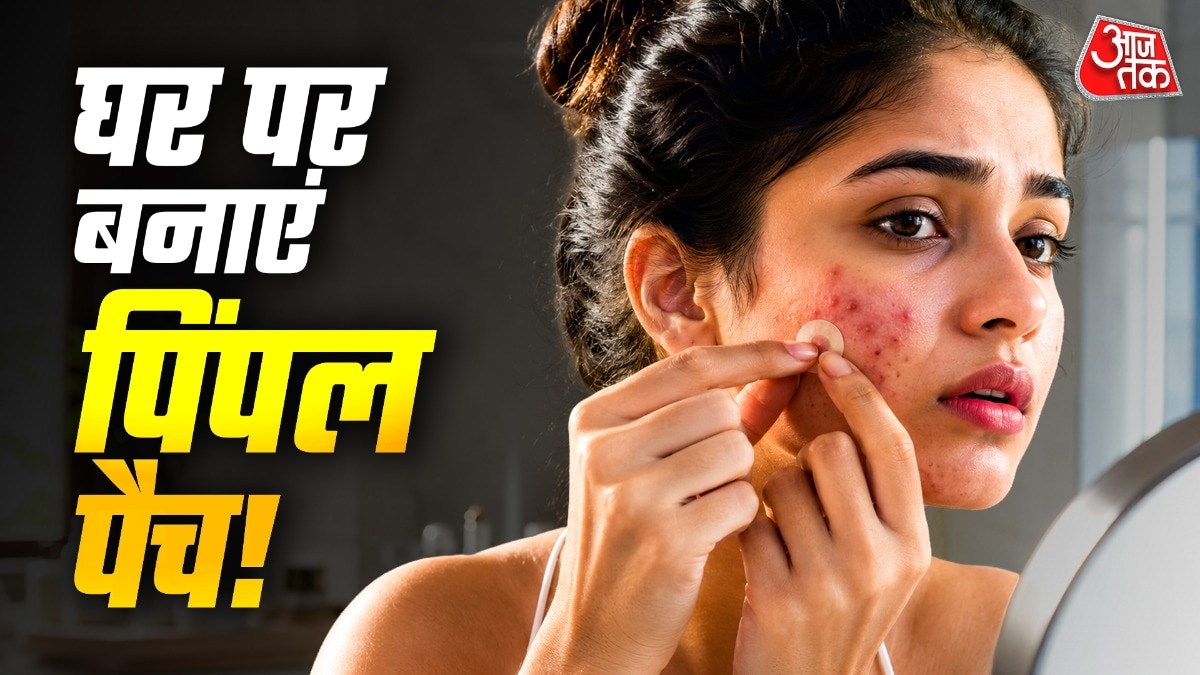 Pimple Patch (Photo: ITG)