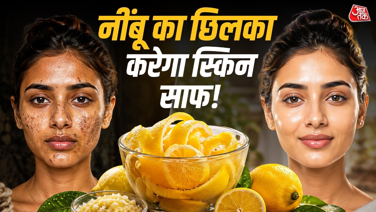 स्किन पर हैं जिद्दी दाग-धब्बे? नींबू के छिलके की ट्रिक से मिलेगी राहत