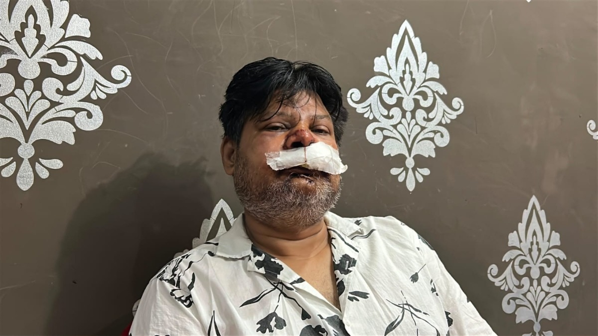 रंगदारी नहीं दी तो युवक पर बरसाए डंडे-लोहे की रॉड, अधमरा कर भागे दबंग