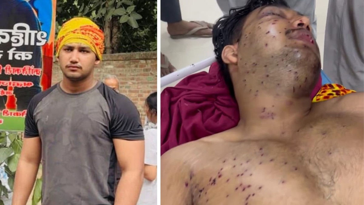 परिवार ने आंख की रोशनी पर जताई आशंका (Photo: ITG)