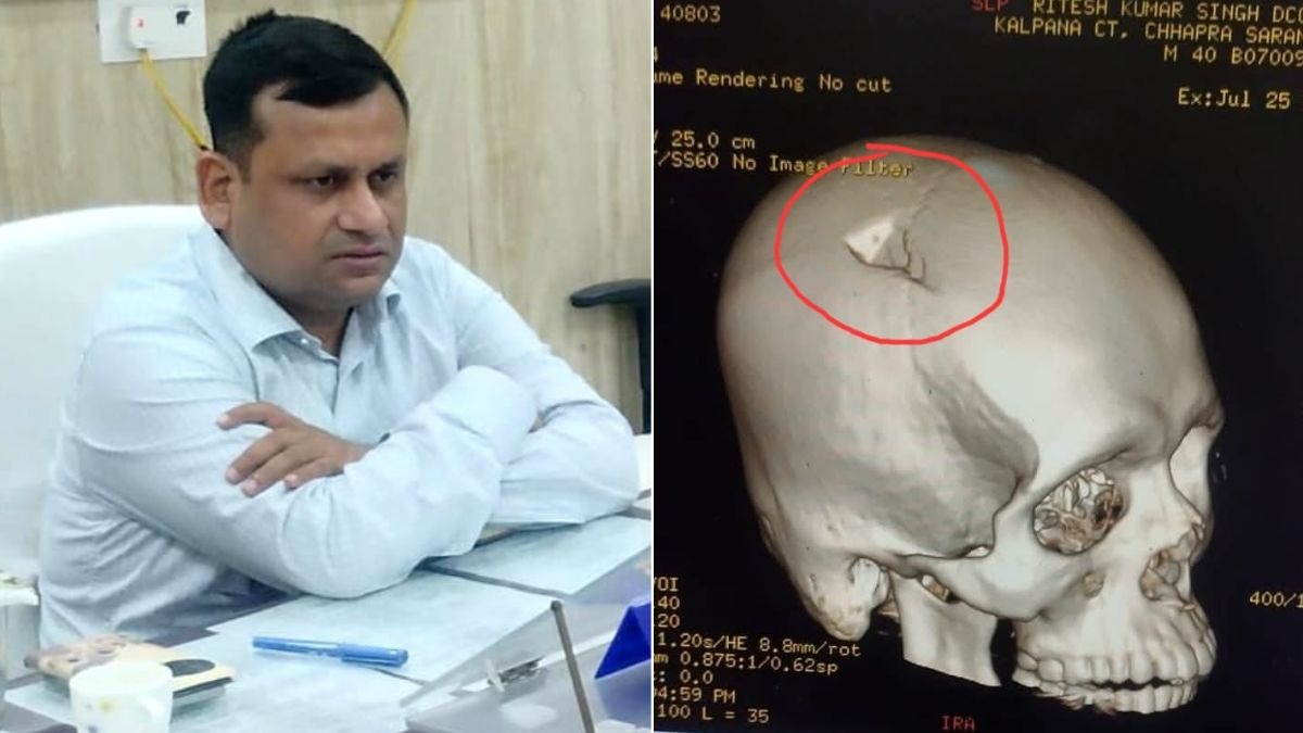 पटना के अस्पताल में भर्ती हैं बीडीओ. (Photo: ITG)
