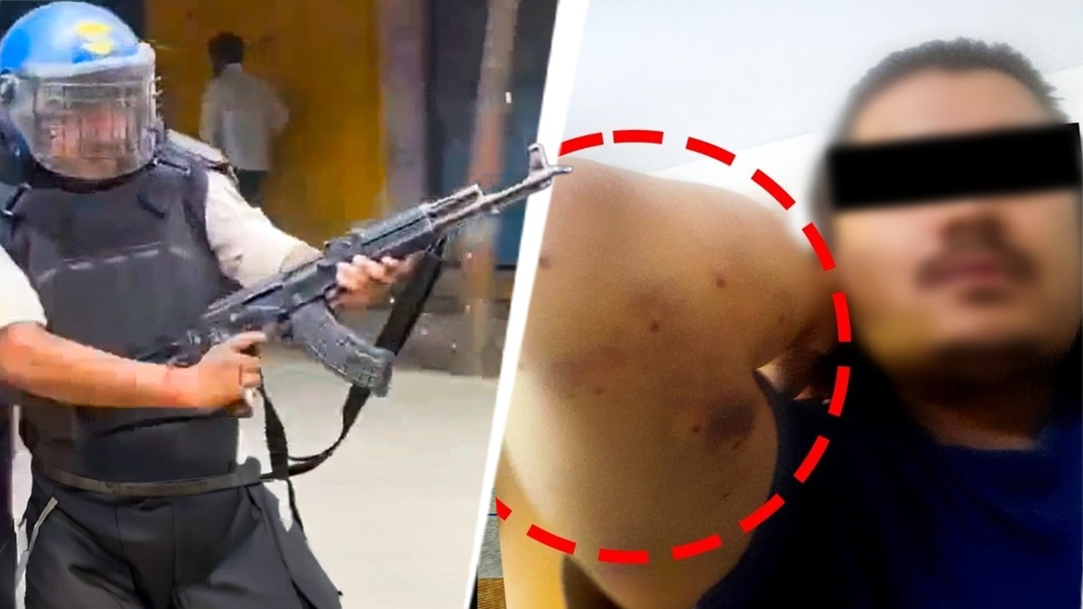 पेपर लीक का विरोध कर रहे छात्रों पर एके-47 तानने और पैलेट गन चलाए जाने के मामले में पुलिस घिरती दिख रही है 