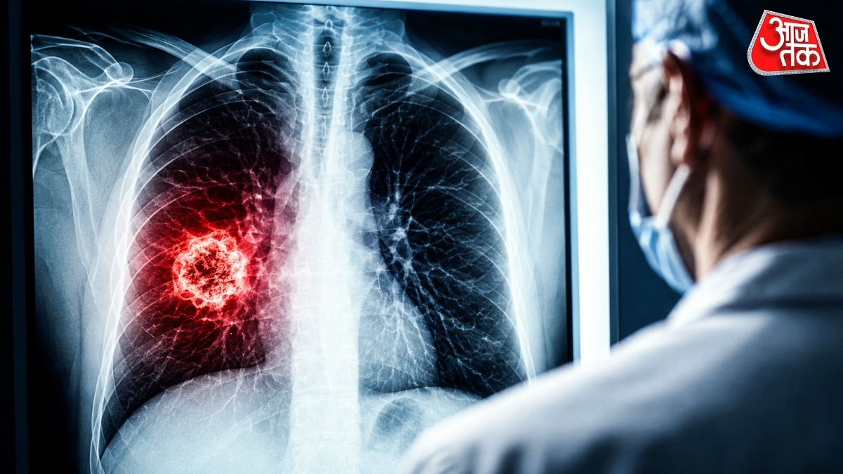 Lungs Cancer Risk and agarbatti 