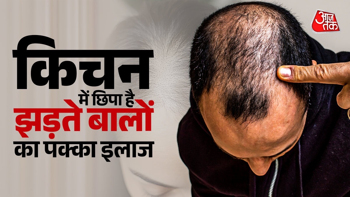 How to Stop Hairfall: बारिश-मॉनसून में तेजी से झड़ रहे हैं बाल? सिर पर इस तरह लगाएं प्याज का रस, हेयरफॉल की होगी छुट्टी