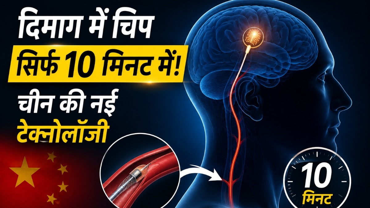 चीनी कंपनी का दावा- 10 मिनट में ब्रेन में लगेगी चिप