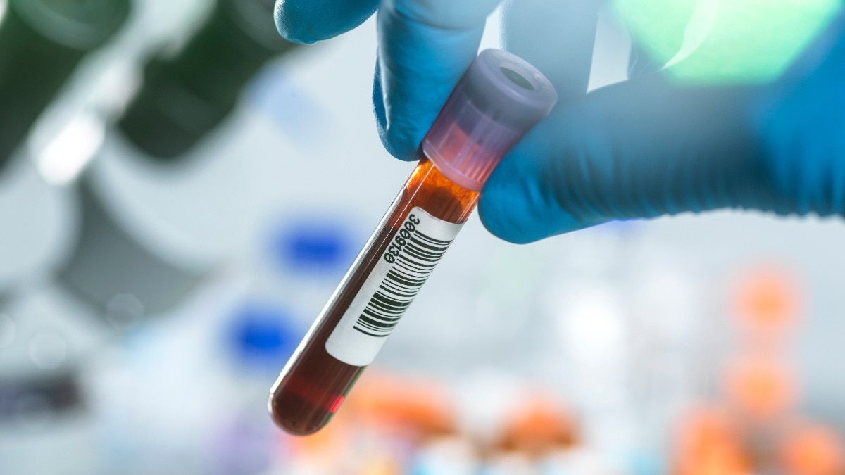 ApoB Blood Test