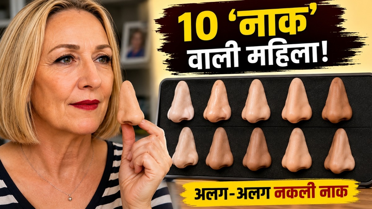 एक बीमारी की वजह से जेन की नाक की बनावट धीरे-धीरे बदलने लगी और वह बैठती चली गई. ( Photo: Insta/ sikhle_india)