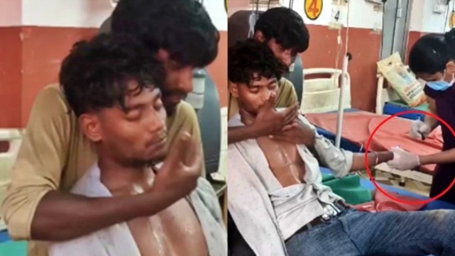 21 वर्षीय अरुण को जहरीले सांप ने डस लिया था (Photo- Screengrab)