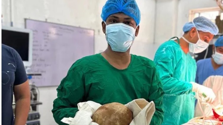 Urinary bladder stone
