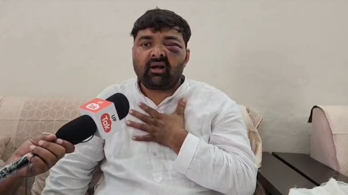 कपड़े उतारकर ‘चोली के पीछे’ गाने पर डांस कराने का आरोप, दिग्विजय भाटी ने SSP ऑफिस में थर्ड डिग्री का आरोप – meerut digvijay bhati alleges third degree torture dance ssp office lclar
