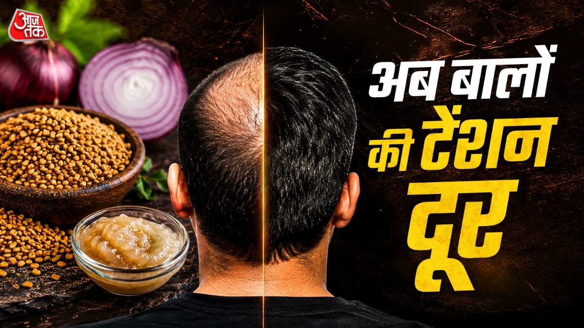 बालों का झड़ना रुकेगा (Photo: ITG)