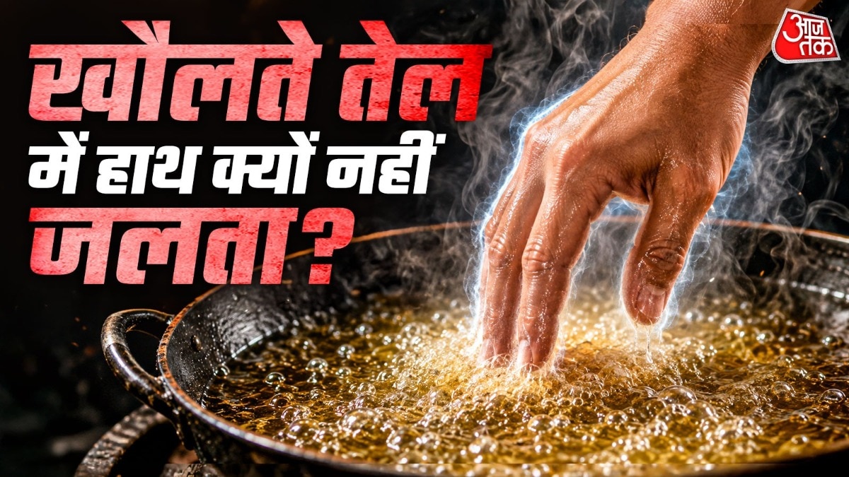 गर्म तेल त्वचा को गंभीर रूप से जला सकता है और चोट लंबे समय तक परेशानी पैदा कर सकती है. ( Photo: ITG)