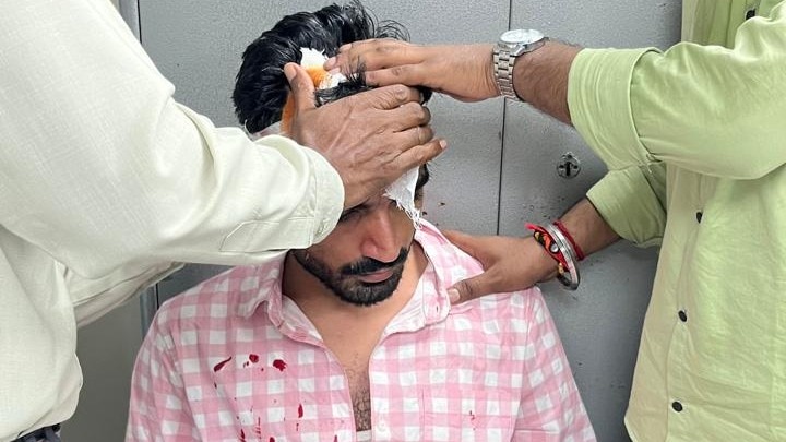 एबीवीपी कार्यकर्ता चुनाव प्रचार में घायल 