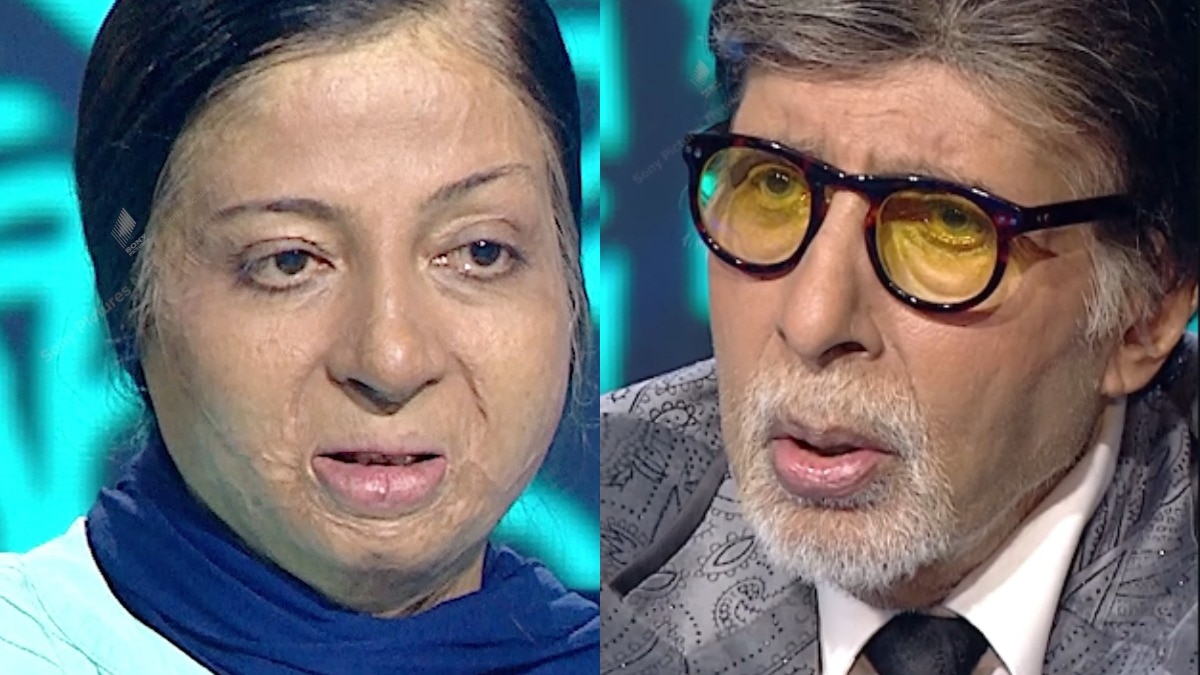 Amitabh bachchan gets emotional bilaspur kapila dowry burnt case kbc