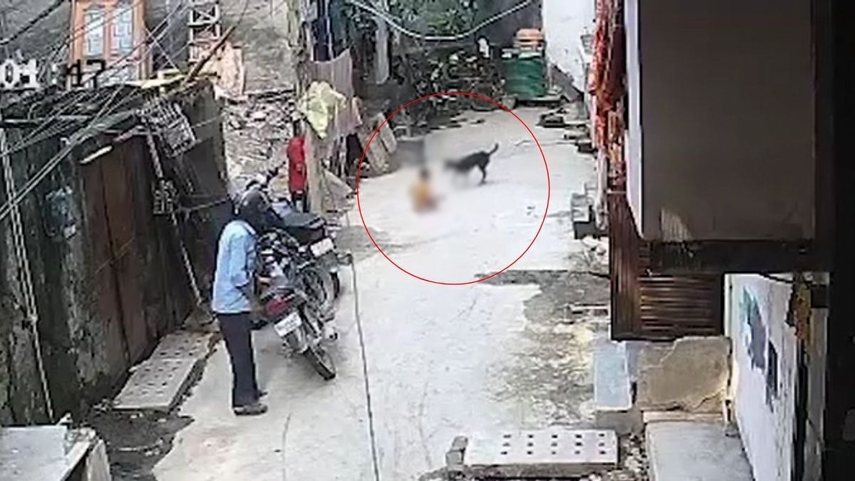 कुत्ते ने नोच लिया बच्चे का गाल. (Photo: Screengrab)