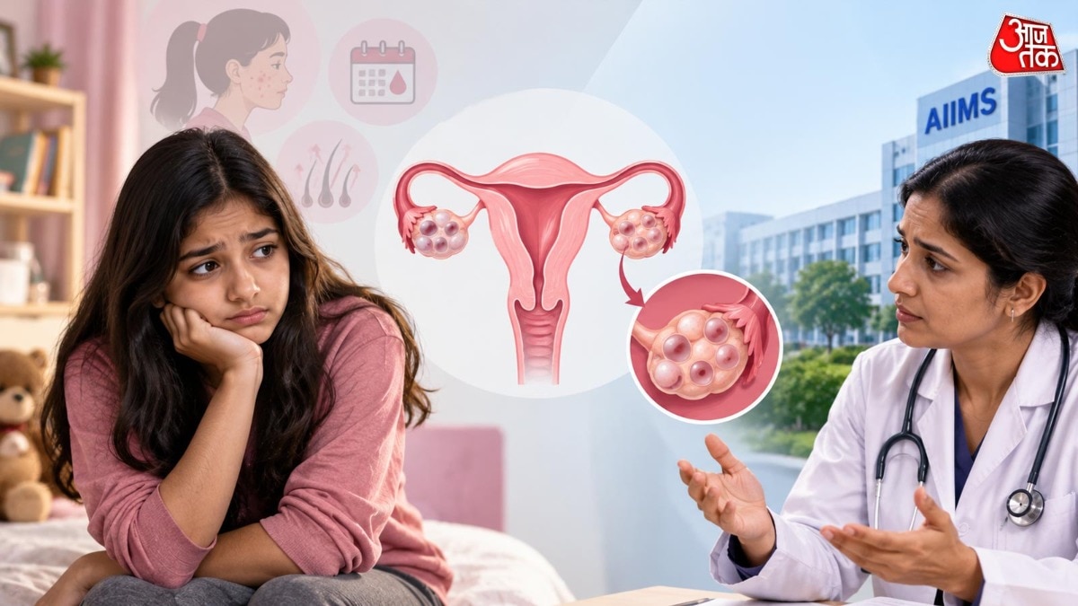 कम उम्र में हो रही PCOS की बीमारी