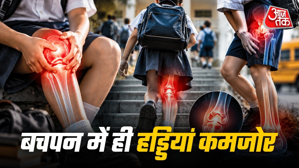 स्कूल जाने वाले बच्चों की हड्डियां कमजोर ( Photo-ITGD) 