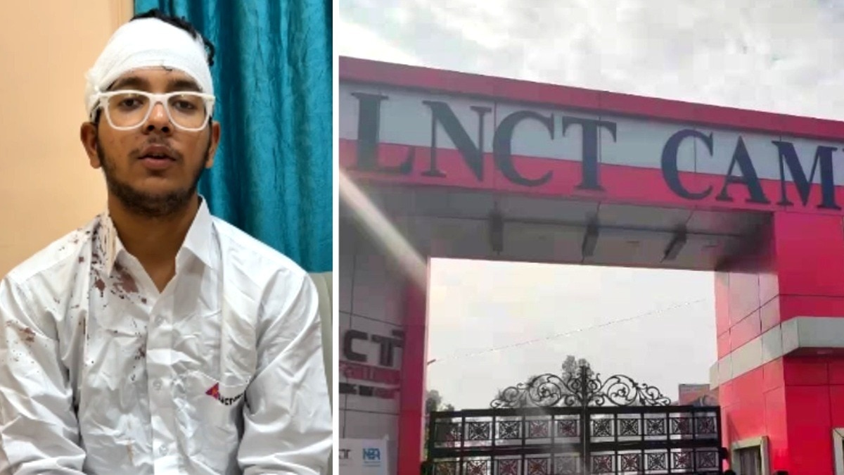 LNCT कॉलेज प्रशासन पर लगा मामला दबाने का गंभीर आरोप.(Photo:ITG)
