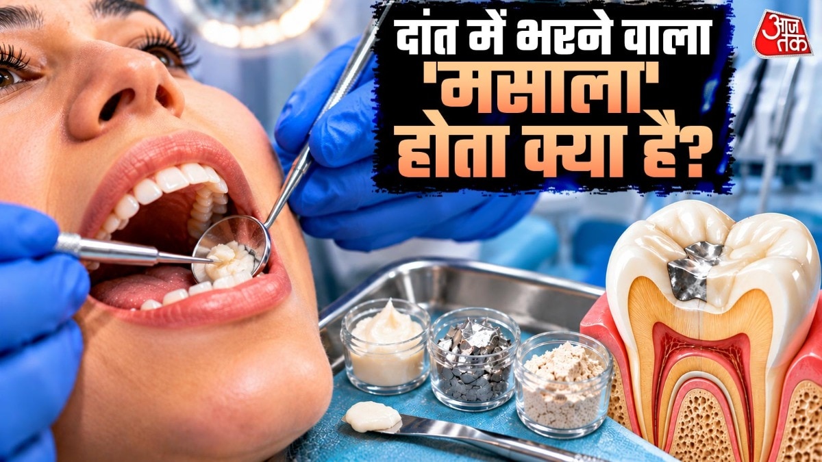  मरीज की जरूरत के हिसाब से डॉक्टर अलग-अलग मटेरियल का इस्तेमाल कर सकते हैं. ( Photo: ITG)