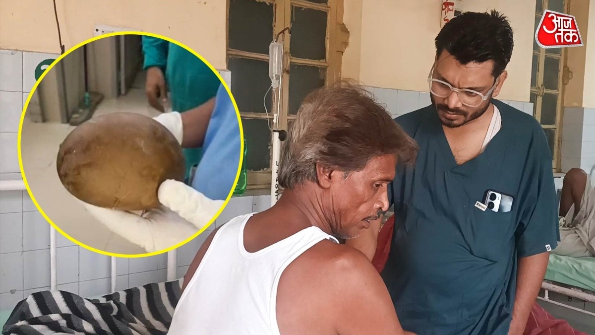 डॉक्टर प्रशांत मिश्रा ने ऑपरेशन करके शरीर के अंदर से डेढ़ किलो का पत्थर निकाला (Photo: ITG)