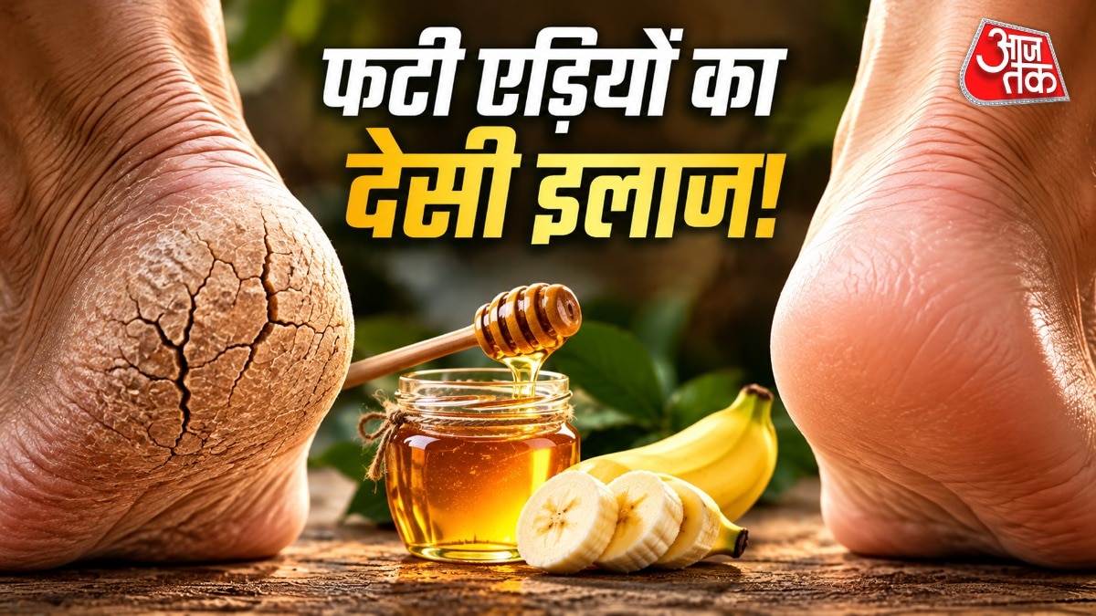 फटी एड़ियों को ठीक करने के लिए शहद का इस्तेमाल किया जा सकता है. (Photo: ITG)