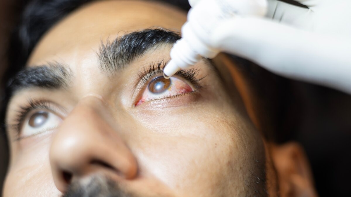 A repurposed blood pressure drug could manage corneal wound scarring. (Photo: Getty Images)