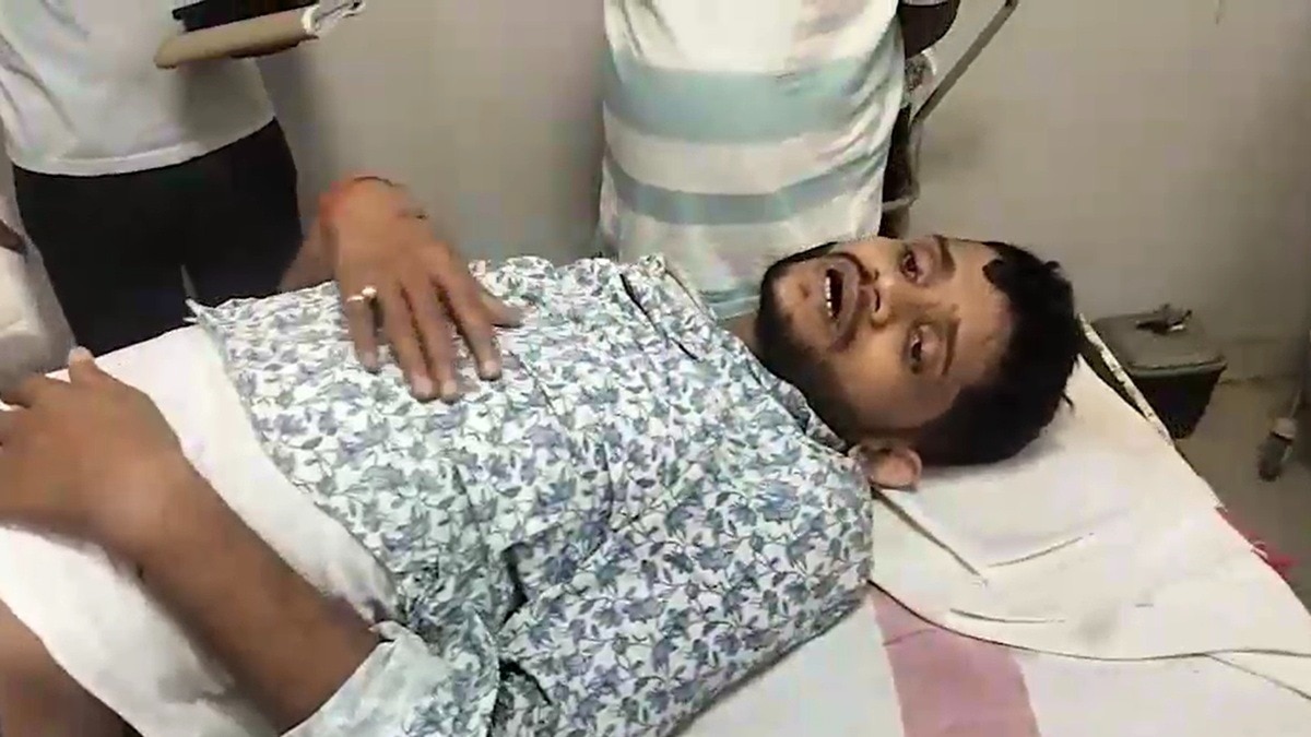 एनकाउंटर में घायल आरोपी सौरभ कुमार. (Photo: Screengrabs)