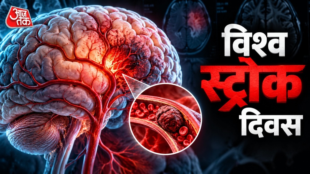 ब्रेन स्ट्रोक एक खतरनाक बीमारी है