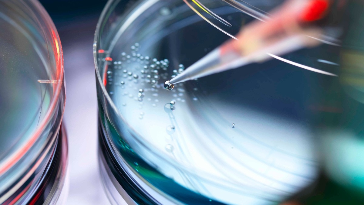 stem cell therapy
