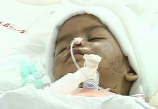 एम्‍स में भर्ती मासूम