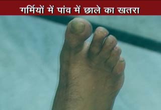 डायबिटीज के मरीज