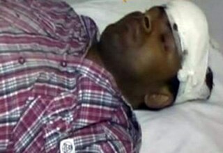 नाबालिग की कार से घायल युवक