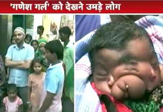 भगवान गणेश की सूरत लेकर पैदा हुई बच्ची