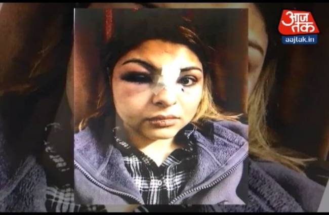 प्रियंका की पिटाई की तस्वीरें