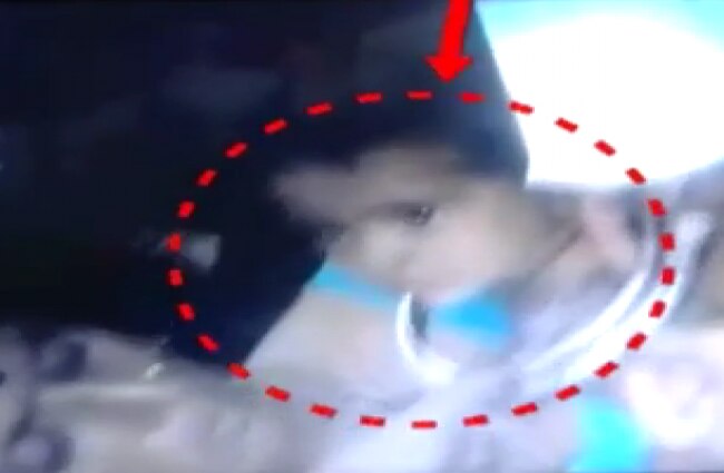 मटके में फंसा बच्ची का सिर