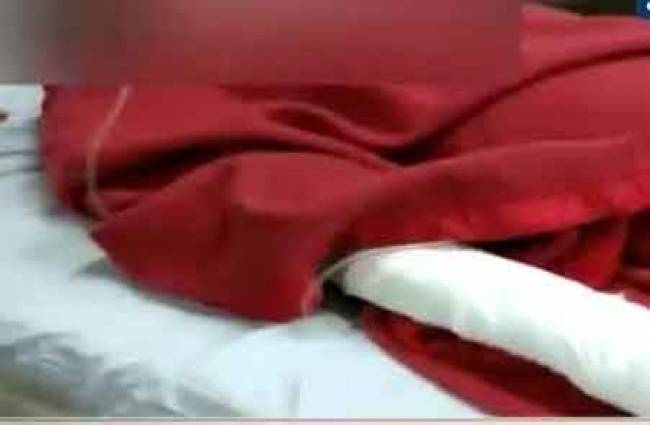 बॉयफ्रेंड की बहन ने फेंका तेजाब