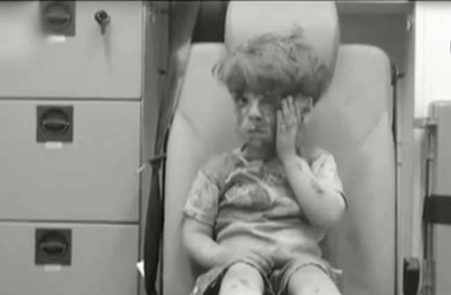 5 साल का ओमरान हमले में लहूलुहान हो गया