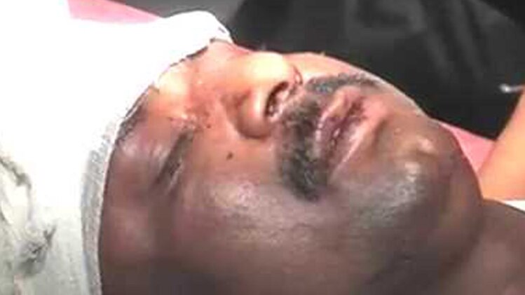 माफिया का हमला