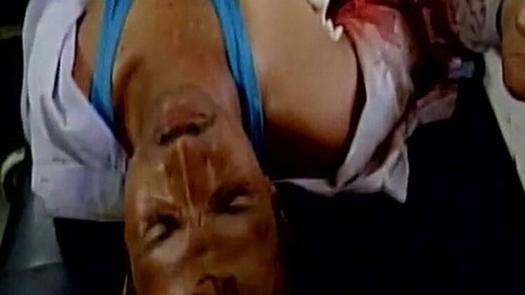 नॉनस्टॉप 100