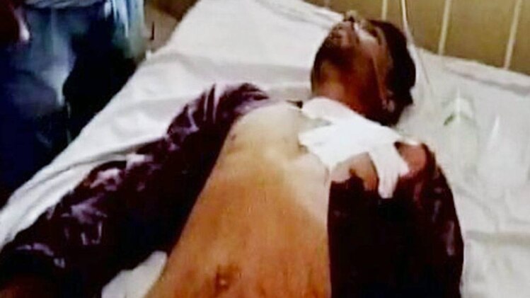 2 किसानों की मौत हुई