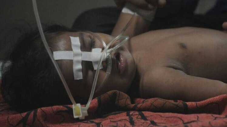 अब तक बीआरडी में 76 मौत