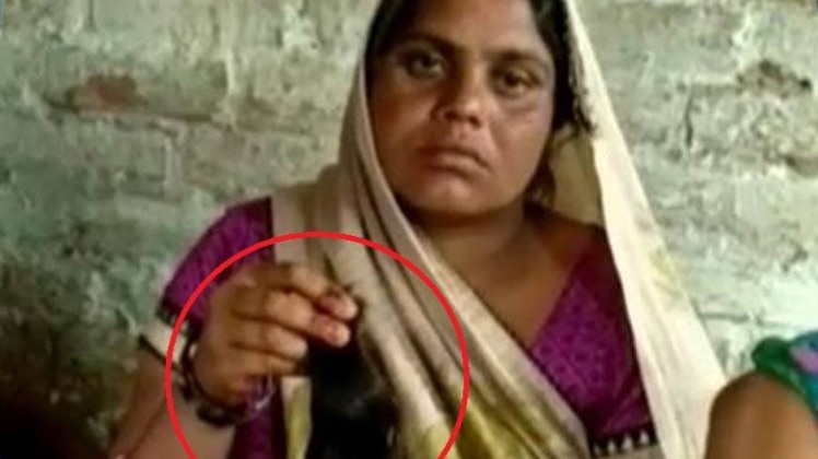 देश के कई शहरों में कटती चोटी का कहर!