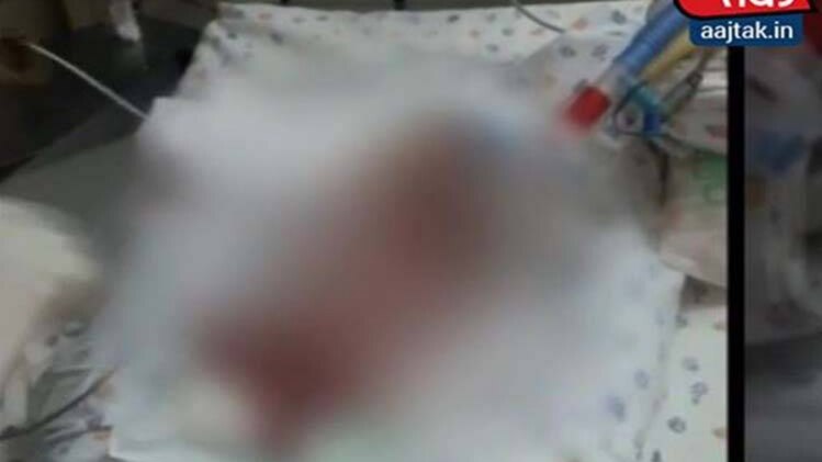 दिल्ली के मैक्स हॉस्पिटल की Maximum लापरवाही