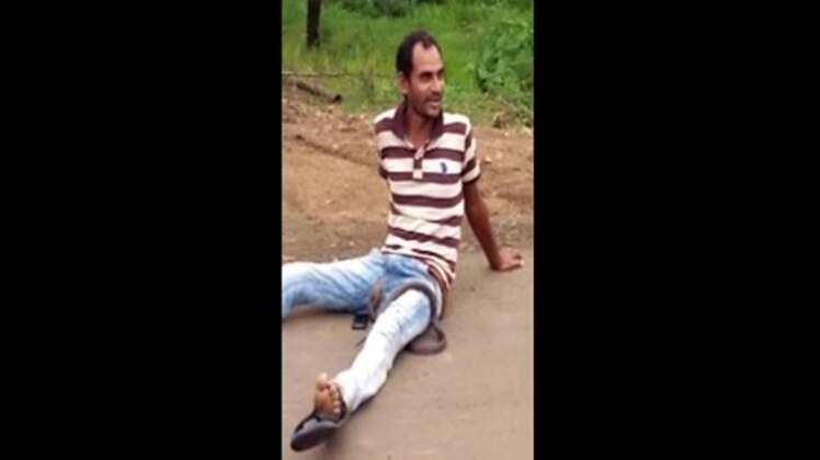 नशा करने के बाद सांप से मस्ती करना युवक को पड़ा भारी