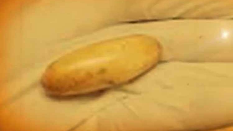 कैप्सूलों के जरिए पेट में करोड़ों छिपाने की कवायद