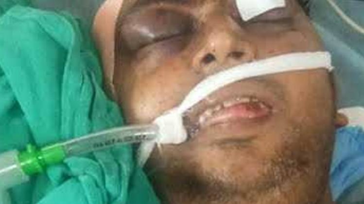 जख्‍मी युवक अस्‍पताल में जिंदगी की जंग लड़ रहा है