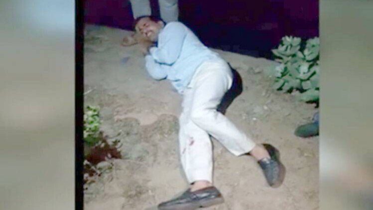 जख्मी बदमाश ताज मोहम्मद