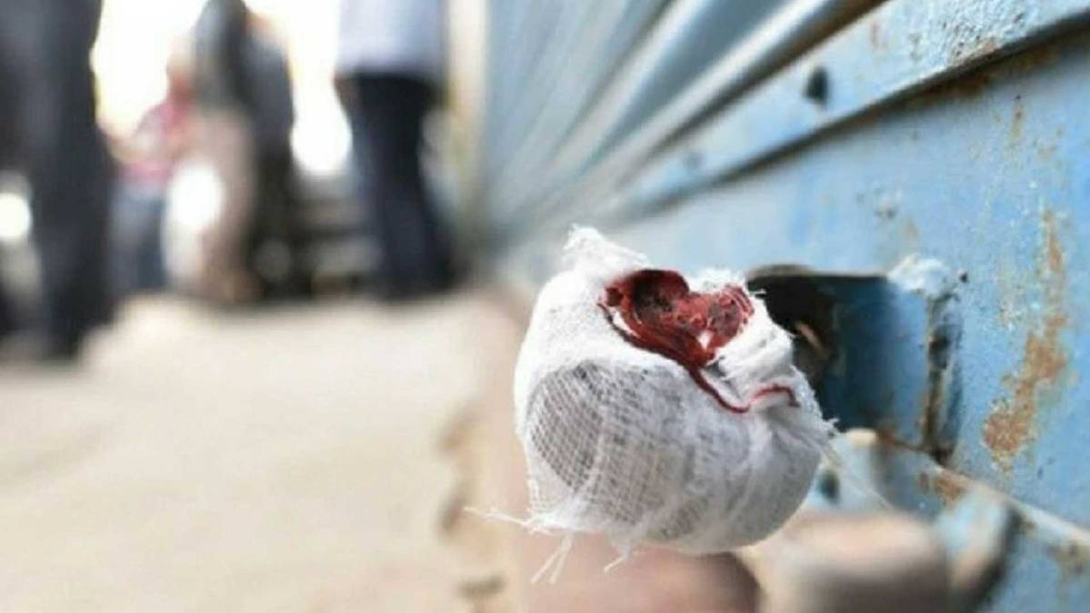 प्रतीकात्मक तस्वीर